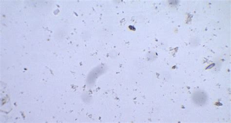 Giardia Lamblia Trophozoite Parasitology