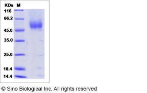 Human Recombinant FGFR2 CD332 Protein Beta IIIc His Tag From