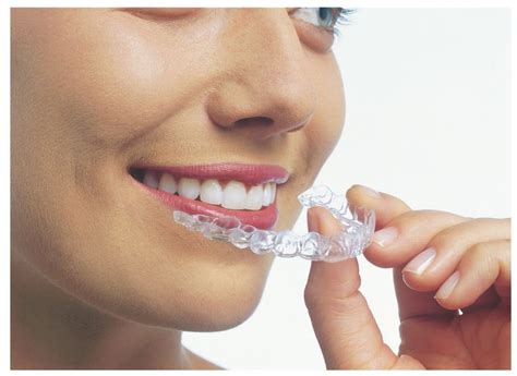 Invisalign For Teens Advanced Orthodontics Mesa Braces