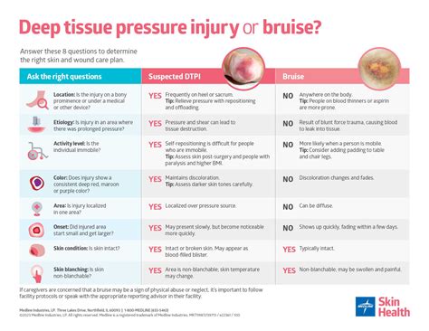 Deep tissue pressure injury vs. bruise: Know the differences