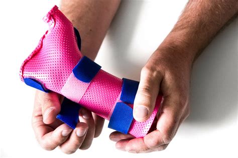 Scaphoid Fracture Treatment Melbourne Gippsland