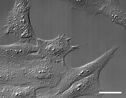 Differential Interference Microscopy (DIC) | Principle & Applications ...