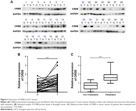 Creb Promotes Laryngeal Cancer Cell Migration Via Myct Nat Axis Ott