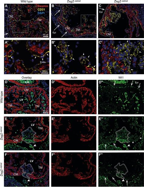 Endothelial Cd31⁺ And Epicardial Wt1⁺ Cells Expand In E115 Dsg2mtmt Download Scientific