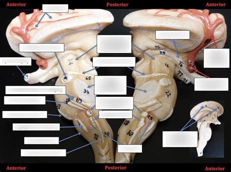 Brainstem Diagram | Quizlet