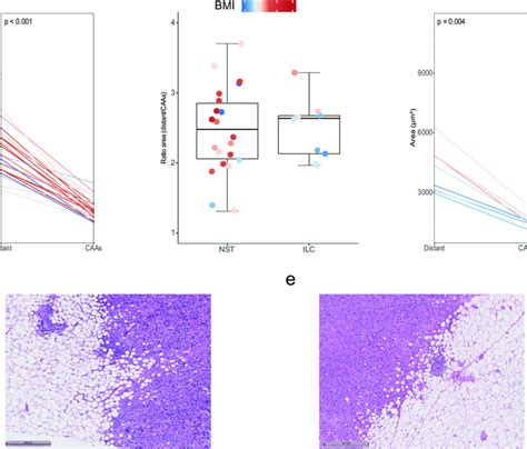 Adipocyte Size And Histological Subtypes A B Parallel Plots Show The