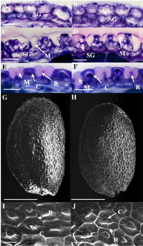 Seed Coat Epidermal Cell Differentiation In The Cesa Mutant A To F