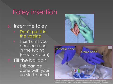 Foley Catheter Insertion Female Anatomy Mastering Foley Catheter