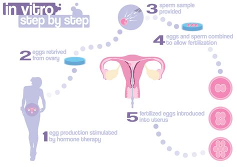 Ivf Treatment Kic Delfinium Fertility Centre