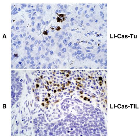 Immunohistochemical Staining For Cleaved Caspase 3 To Detect Apoptotic