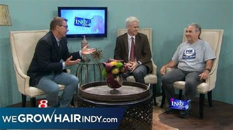 Don Stuck On Indy Style Amazing Hair Transplant Results Months Post