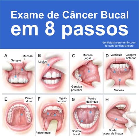 Maio Vermelho Preven O Do C Ncer De Boca Medo De Dentista