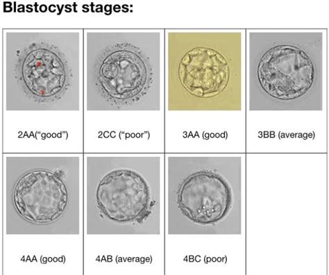 What Having A Perfect Embryo Actually Means The IVF Warrior