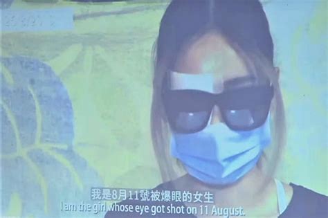 香港黑暴中的“爆眼女”眼睛没事，笑着去台湾了凤凰网