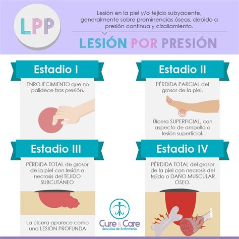 Lesiones Por Presión Ulceras Por Presion Enfermeria Lesiones Por
