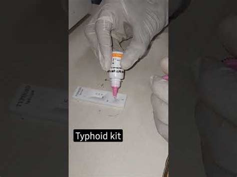 Typhoid Test Kit Widal Test Kit Latest Price Manufacturers Suppliers