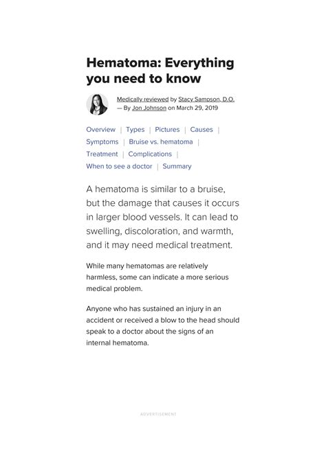 solution hematoma overview types treatment  pictures studypool