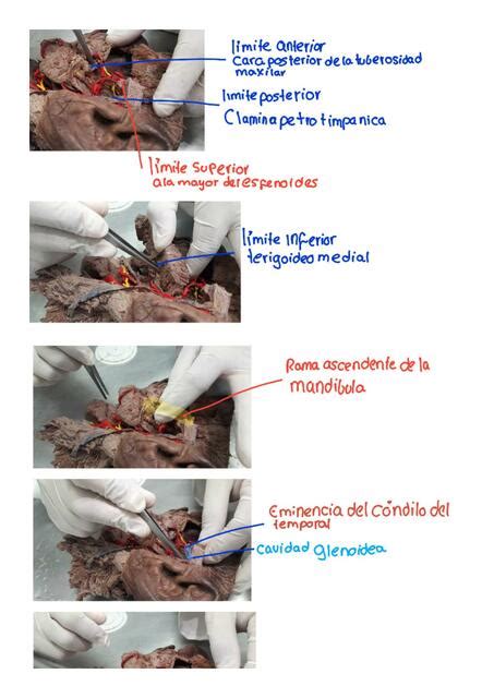 Resumen Anatomia Craneo Carolina Valdivia UDocz