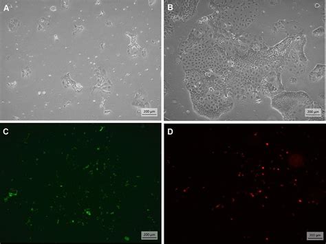 Images Of Caco Cells In Phase Contrast And Fluorescence Microscopy