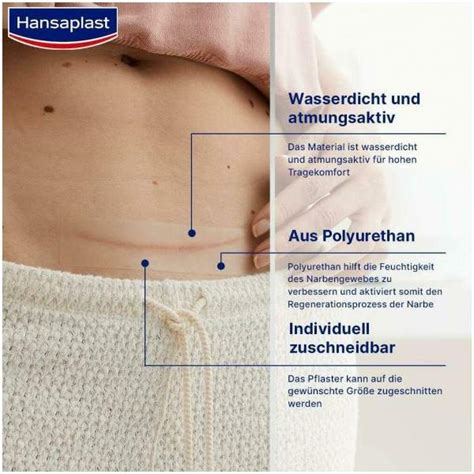 Hansaplast Pflaster Narben Reduktion Xl 3 Cm X 14 6 Cm 21 Stück Kaufen