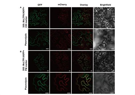 Subcellular Localisation Of Mcltpii In Leaf Epidermal Cells Of N