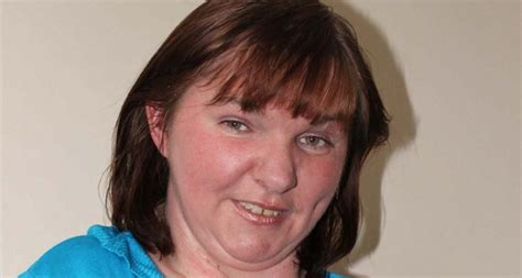 After 40 Surgeries Irish Woman Ann Marie Healy Reveals What Its Really