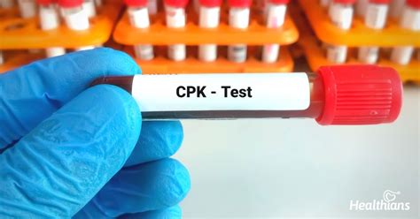 CPK Test: Purpose, Results & Preparation - HEALTHIANS BLOG