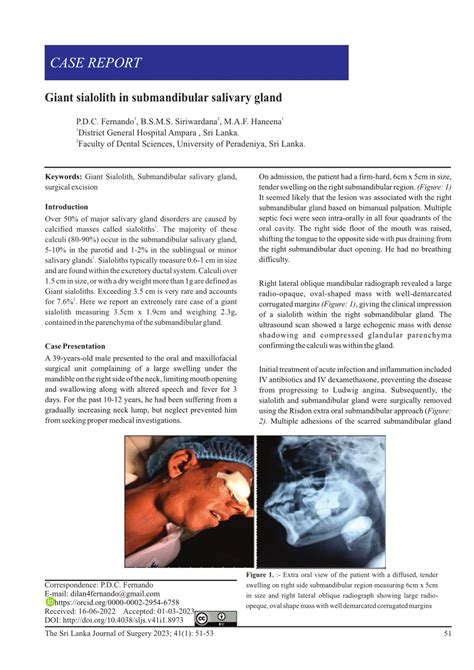 PDF CASE REPORT Giant Sialolith In Submandibular Salivary Gland 1 2 1