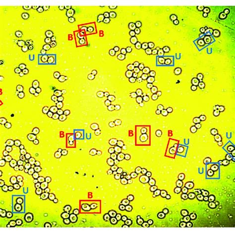 An Image Showing Yeast Cells Available For Analysis The Labels B Download Scientific