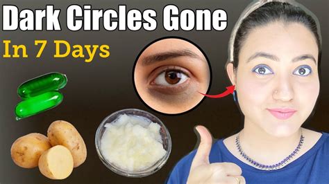 Remove Dark Circles Spots Puffy Eyes Permanently In 2 Weeks DIY