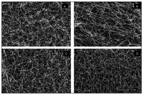 Representative Scanning Electron Micrographs Of Fibrin Clots Download Scientific Diagram