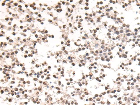 Ssb Anti Ssb Rabbit Polyclonal Antibody