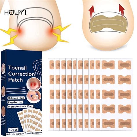 50 Pcs Ingrown Nail Correction Stickers Elastic Breathable Paronychia