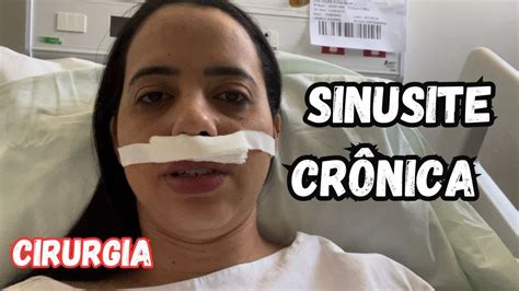 Sinusite Crônica Fúngica Sinusectomia Minha Experiência Pessoal e