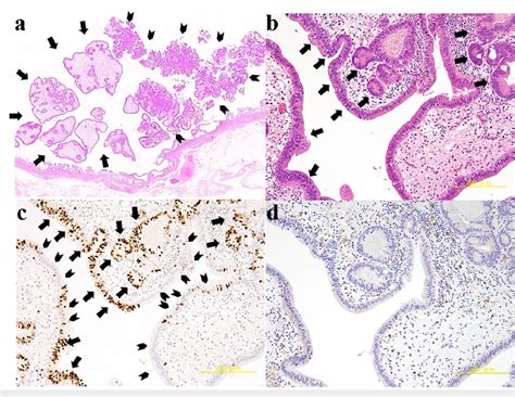 Microscopic Appearance Of The Resected Specimens Download Scientific