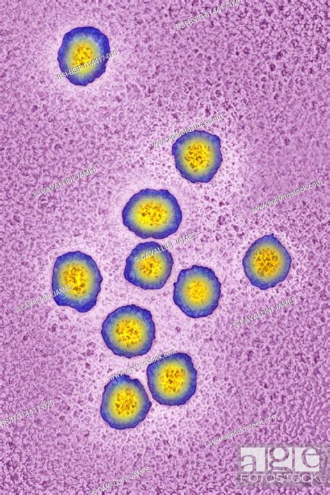 Hepatitis C Virus HCV Image Produced Using High Dynamic Range