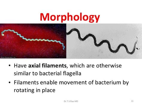 Syphilis Treponema Pallidum