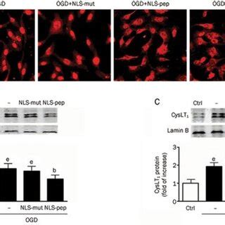 Nuclear Localization Of The CysLT1 Receptor In EA Hy926 Cells Confocal