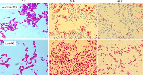 The spore staining results of B. cereus 0–9 and its ΔspoVG mutant ...