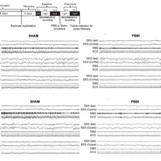 A Schematic Of Experimental Timeline For EEG EMG ECG Recording And