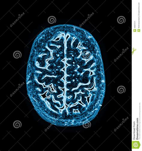 Magnetische Resonantiebeeld Mri Van De Hersenen Stock Afbeelding