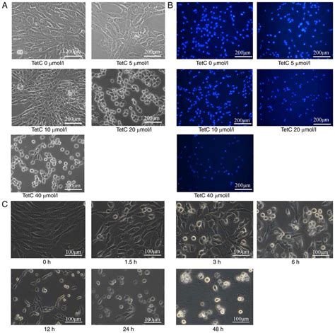 Effect Of TetC On Intracellular Vacuolization And Apoptosis In Human