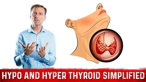 Hyperthyroid Vs Hypothyroid Explained By Dr Berg Youtube