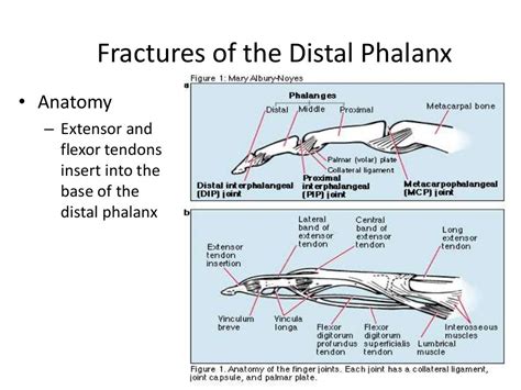 Distal phalanx fracture