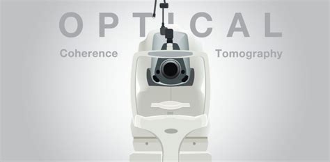 What is an OCT eye scan? - Dr. Coward & Associates