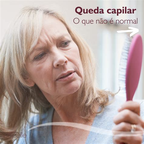 Queda Capilar O Que N O Normal Cepelle Dermatologia Curitiba