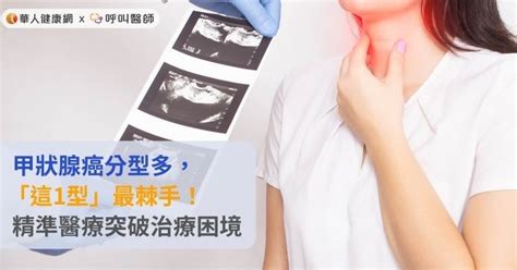 甲狀腺癌分型多，「這1型」最棘手！精準醫療突破治療困境 蕃新聞