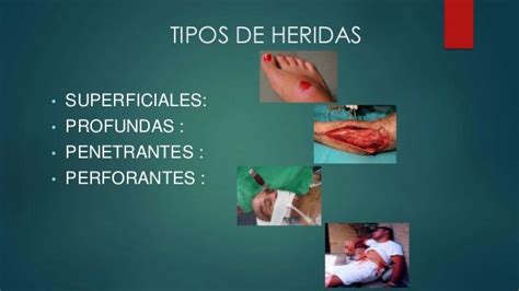 Heridas Y Hemorragias