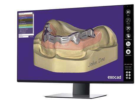 Exocad Implant Lab Bundle Flex Perpetual License Bristol CadCam