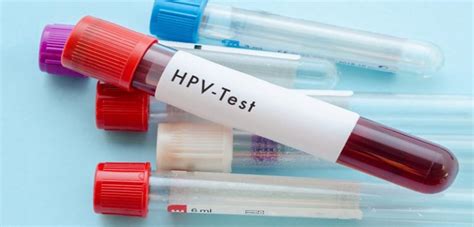 HPV DNA TEST - Primanora Medical Centre